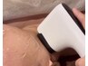【小顔リフト】イットリフトで引き締まったフェイスラインへ