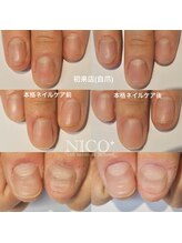 ニコプラス(NICO+)/ジェルネイルができない方向け