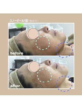 プリマプリート 各務原店/ホワイトスノーピール