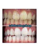 ホワイトニングショップ 所沢店/ホワイトニングショップ所沢店