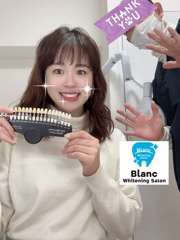 ブラン 心斎橋店(Blanc)/ホワイトニング施術例