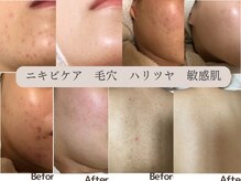 ハンナ(HANNA)