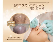 ビー(be.)の雰囲気（根本からしっかりと毛穴の汚れを取り除く毛穴洗浄）