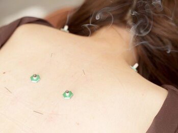 リアライズ(realise)/◆鍼灸/首・肩こり/腰痛/疲れ