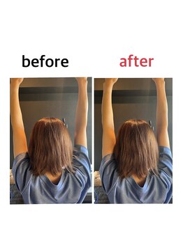 メディカルジャパン 吉祥寺/施術で肩が挙がりやすくなります