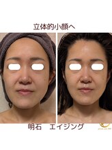 プライベートサロン 美月/立体的小顔