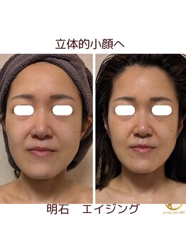 プライベートサロン 美月/立体的小顔