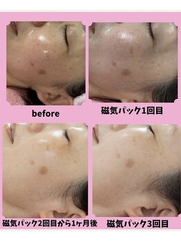 サロン ほほえむ(Fofo-m)/