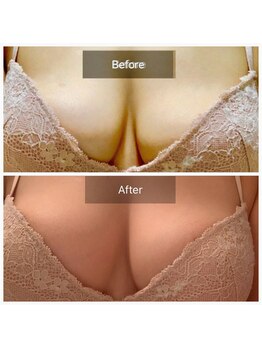 メイ(May)の写真/バストアップしたいなら人体の土台から改善できる当サロンへご相談ください♪