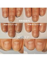 ニコプラス(NICO+)/ジェルネイルができない方向け