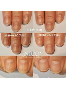 ニコプラス(NICO+)/ジェルネイルができない方向け