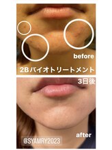 シャムリー 並木坂(Syamry)/お肌悩み改善ハーブ