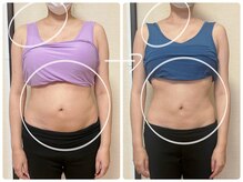 高槻 インサイド(Inside)/ビフォー・アフター