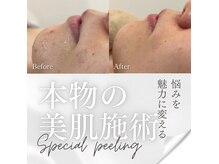 リノ レイ(Lino Ray)