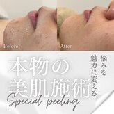 リノ レイ(Lino Ray)