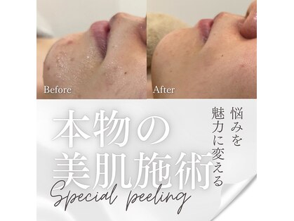 リノ レイ(Lino Ray)の写真