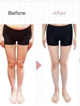 ホッコリ 段原店(HOKKORI)/寝たまま痩身ダイエット