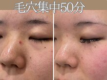 ハウオリ(HAUOLI)/毛穴集中撃退50分