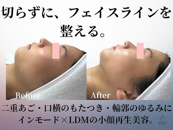 フォルディオ(FORDIO)