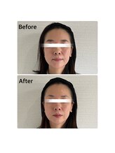 ビープラスサロン(Be plus salon)/