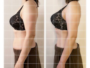 サロン ド メグリィ(Salon de meguli)の写真/背中美人・バスト美人で自分史上最高のボディラインに★バストの位置で見た目年齢層変わります！