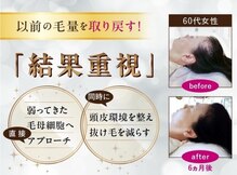 イーズ/リバイタ ららぽーと横浜
