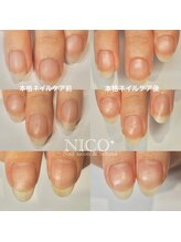 ニコプラス(NICO+)/ジェルネイルができない方向け