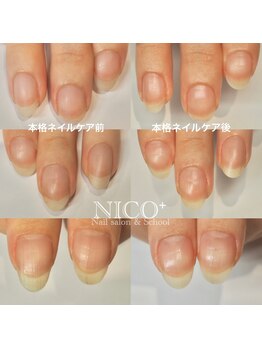 ニコプラス(NICO+)/ジェルネイルができない方向け