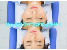 大宮中央カイロプラクティック/小顔に！　美容鍼/小顔/リンパ