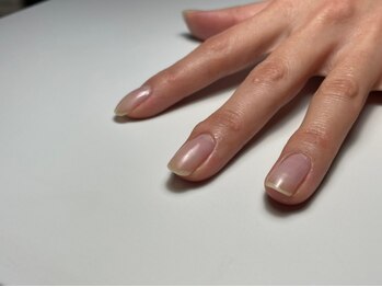 ネイルプルーフ(NAIL proof)の写真/【当店の新しい自爪ケア♪】お爪のコンプレックスを克服し、心身ともに健康で前向きな美しさを叶えます◎