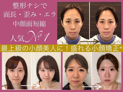 アクアビー(AQUA-B)の写真