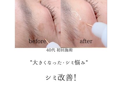 シミリセット 名駅(シミReset)の写真