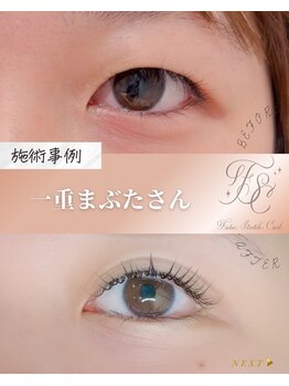 ココラッシュヤナガワ(二重ストレッチカール CoCo Lush 柳川)/二重ストレッチ施術例