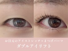 ノンチェ(Nonche)/一重奥二重《ダブルアイリフト》