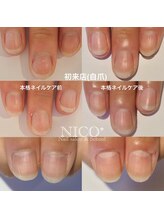 ニコプラス(NICO+)/ジェルネイルができない方向け