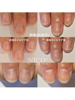 ニコプラス(NICO+)/ジェルネイルができない方向け