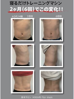 ヒカリ 淡路店(HIKARI)/ビフォーアフター