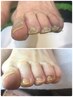 <フット>フットジェルネイルオフ＆フットネイルケア　¥4500