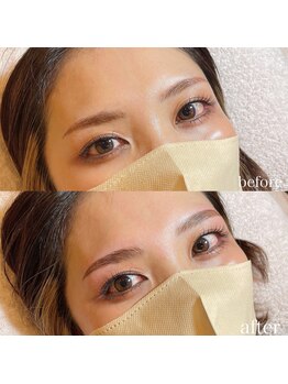 ダリ(Dali)/ハリウッドブロウリフト