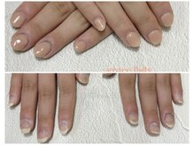 グレースレディ/バレずに矯正