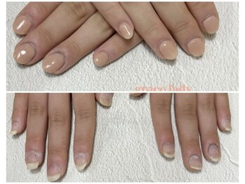 グレースレディ/バレずに矯正