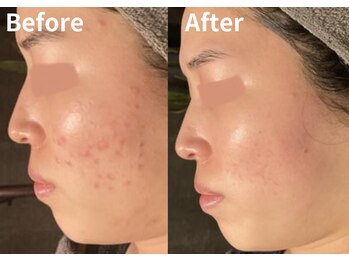 サロン デ ミロ(Salon de Miro)/BeforeAfter多数！ブログへGO♪