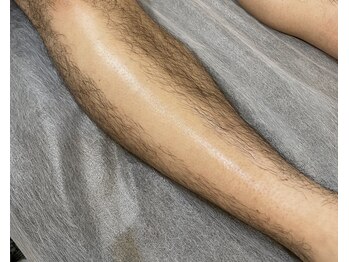 ワクシー 麻布十番店(WAXYYY.)/メンズ脚W脱毛