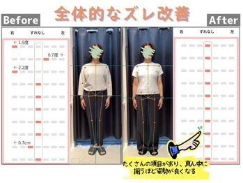 篠丸接骨院/◎全体的なズレ改善◎