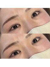 リグ(LIG)/さらにぱっちり！