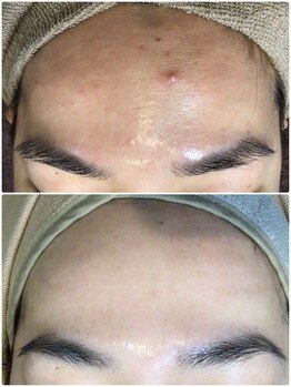 クレビア(CREBIA)/