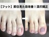 【深爪/噛み爪】即日見た目改善！フット深爪矯正初回お試し
