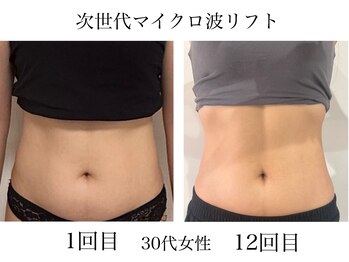 サロンドール(salon doll)/お腹スッキリ引き締め!