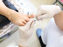 足のケア アンド 巻き爪 エムズ 白金通り店(M's)/ネイルトータルケア1