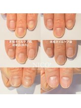 ニコプラス(NICO+)/ジェルネイルができない方向け